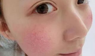 全国花粉过敏预警地图 全国花粉过敏预警地图